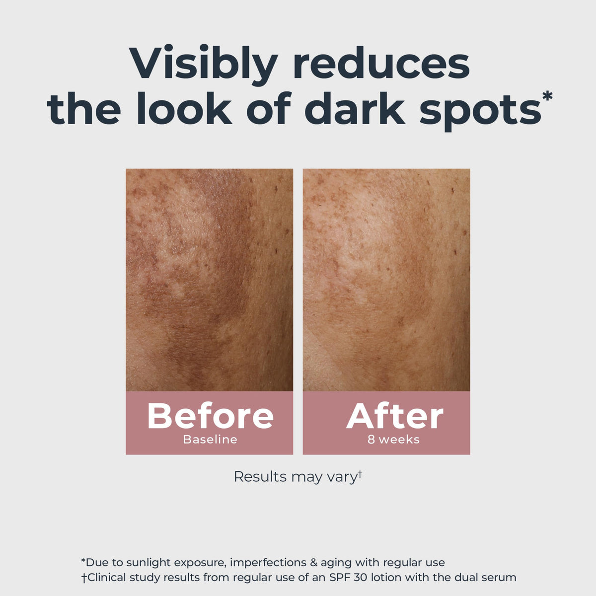 eucerin ingredients label with thiamidol visible emphasizing pigment-targeting benefit