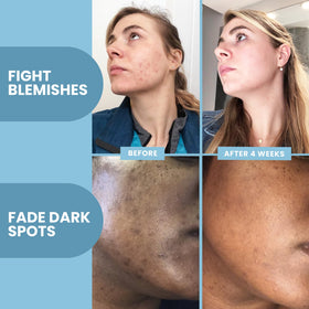 Eva Naturals applied to hand demonstrating easy spread and non-greasy finish benefit