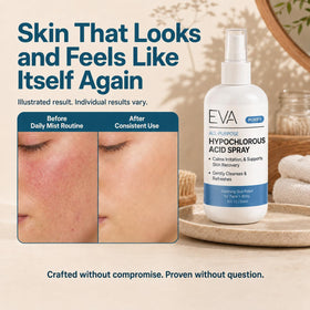 Eva Naturals face application mist soothing redness and calming skin