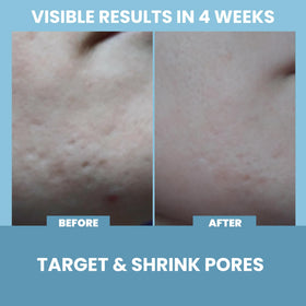 Eva Naturals serum droplet on hand showing lightweight hydrating texture