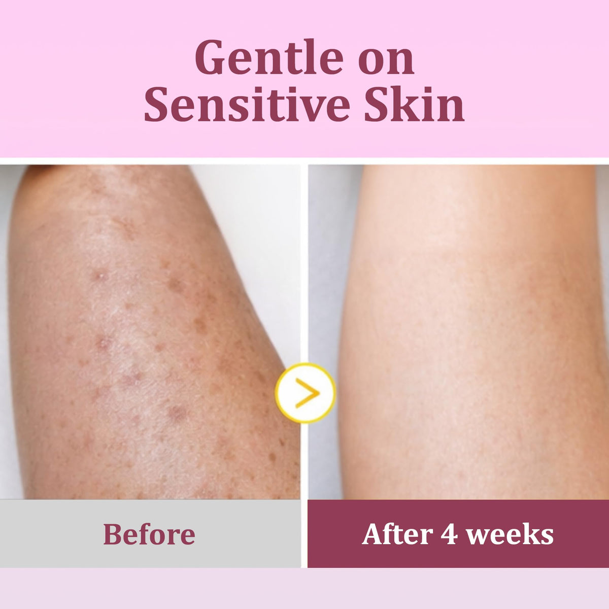 Eveloria pad applied to neck and underarm targeting dark spots