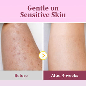 Eveloria pad applied to neck and underarm targeting dark spots