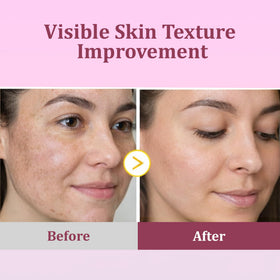 Eveloria pad in use on face gently exfoliating for smoother skin