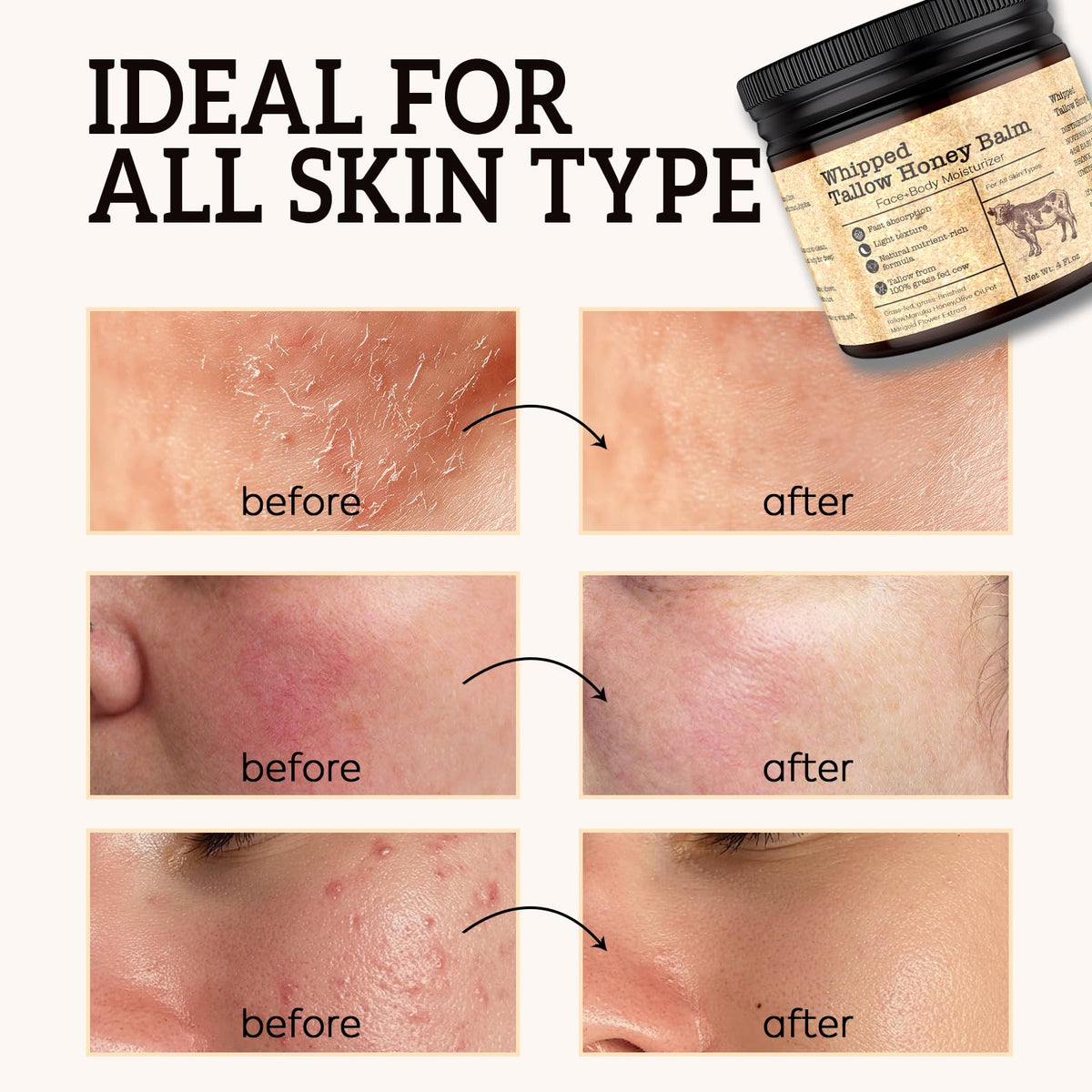 Evervines hands applying balm to cracked skin for barrier support