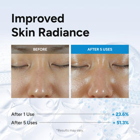 EXOPROXYL serum on hand application, illustrates quick absorption and sheen