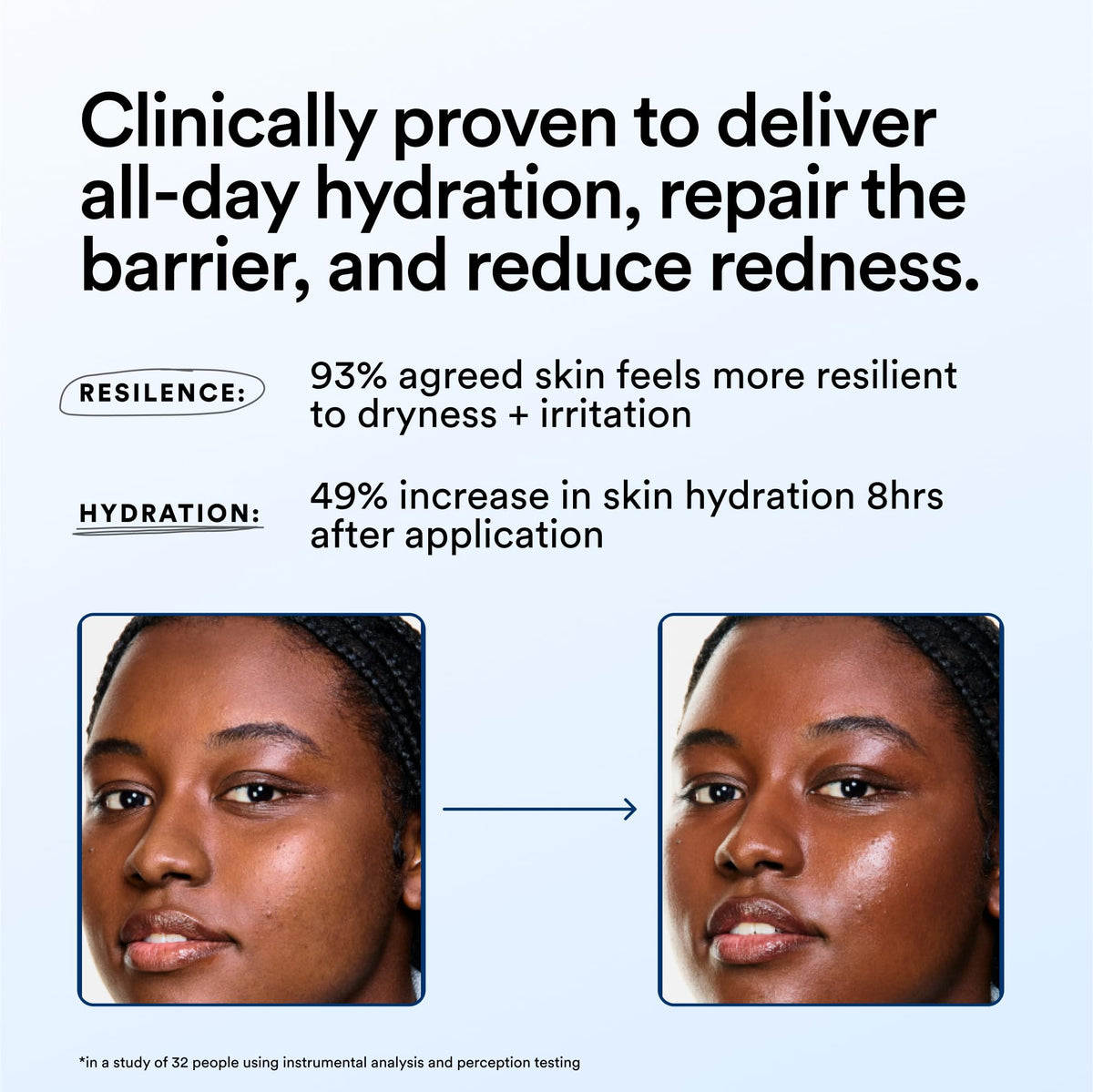 Experiment cream applied to cheek, soothes redness and calms skin