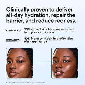 Experiment cream applied to cheek, soothes redness and calms skin