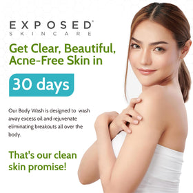 Exposed Skin Care simulated before and after showing clearer-looking skin benefit