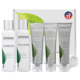 Exposed Skin Care front packaging showing full six-piece acne kit and benefits