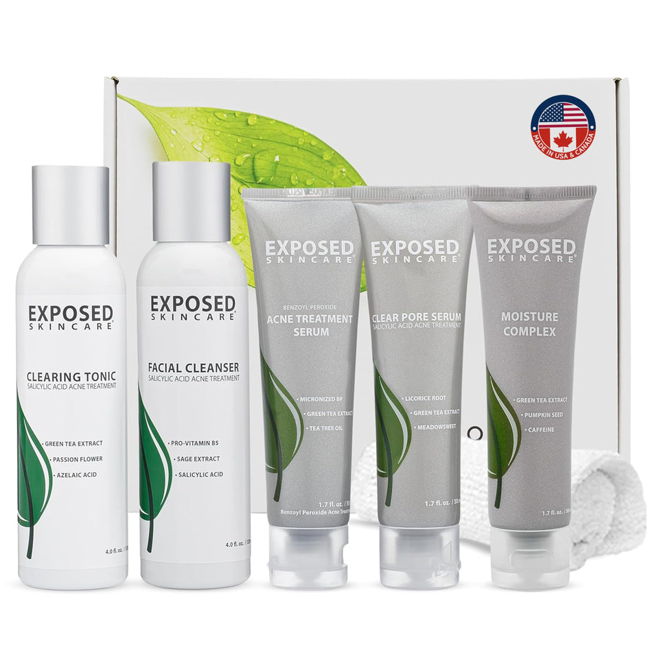Exposed Skin Care front packaging showing full six-piece acne kit and benefits