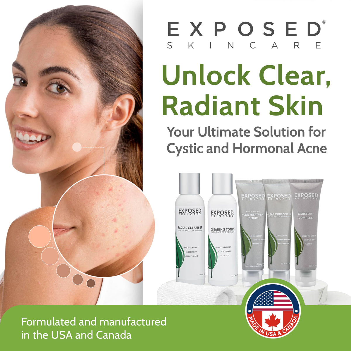 Exposed Skin Care kit contents flatlay showing all six products for a complete routine