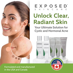 Exposed Skin Care kit contents flatlay showing all six products for a complete routine