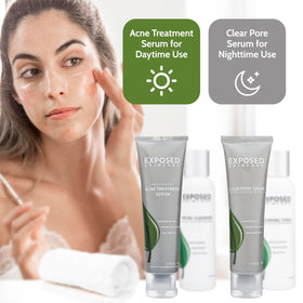 Exposed Skin Care natural ingredients flatlay showing plant-derived supportive components