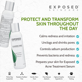 Exposed Skin Care bottle held in hand to show size and travel-friendly benefit