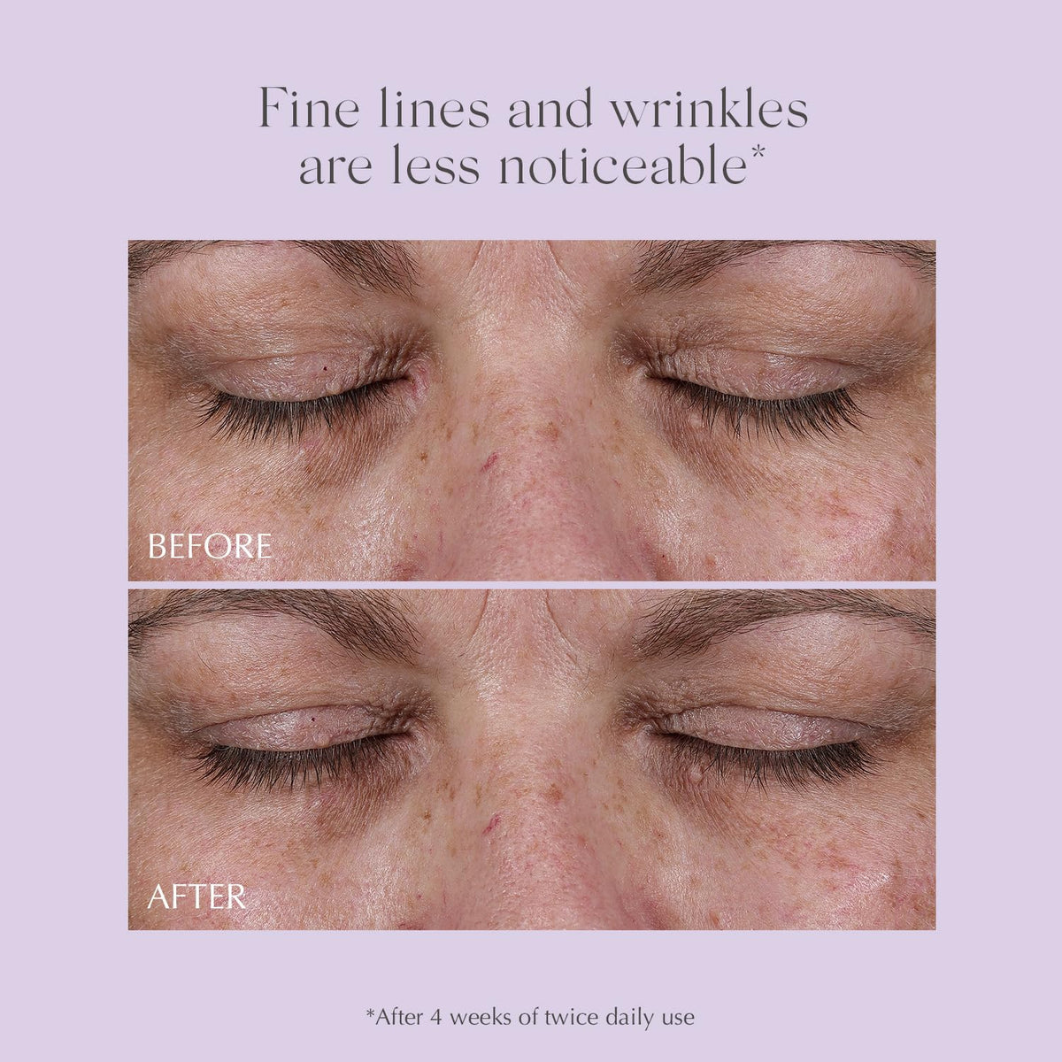 EXUVIANCE cucumber and green tea close-up illustrating soothing botanical actives