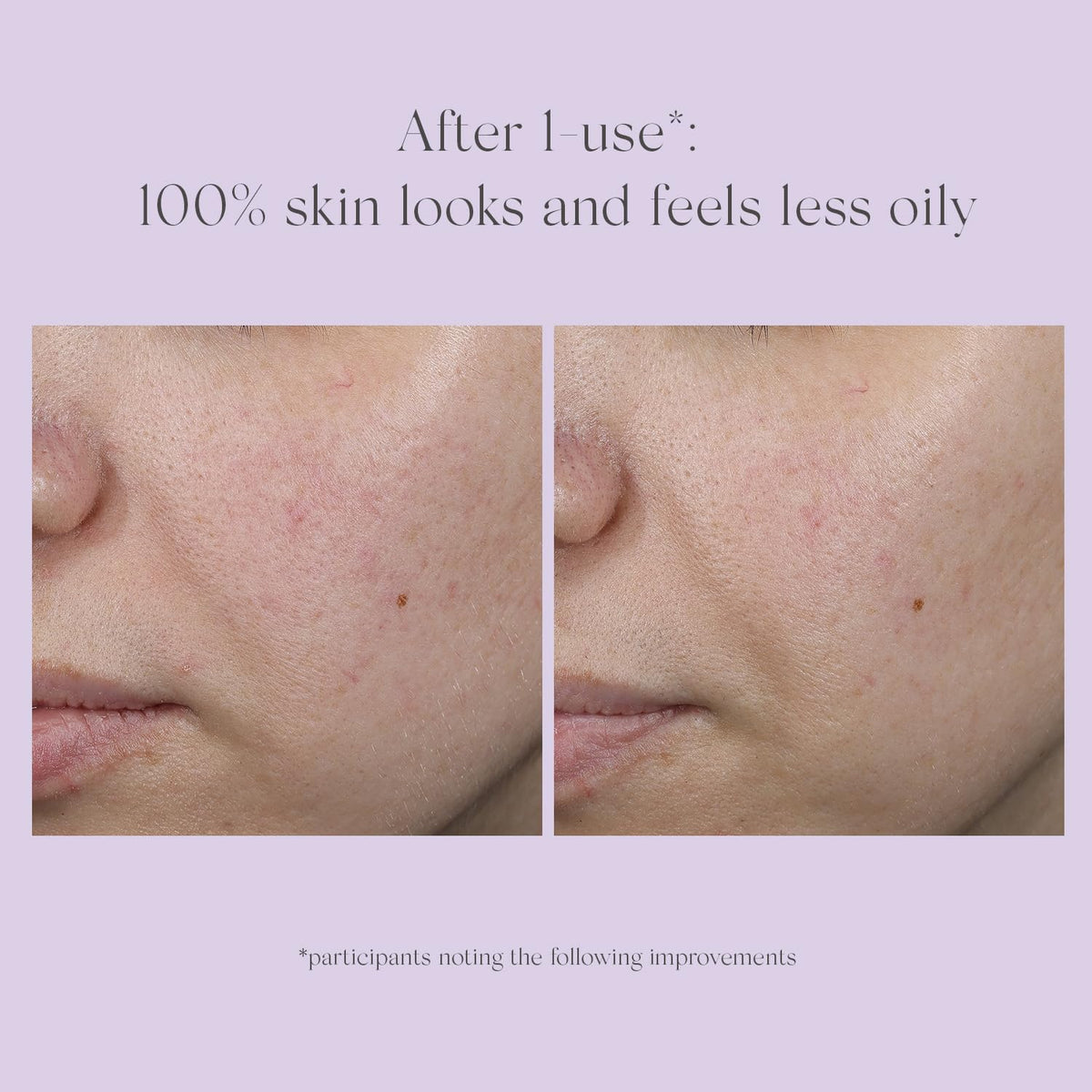 EXUVIANCE staged before and after to suggest texture and brightness improvement