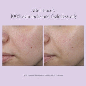 EXUVIANCE staged before and after to suggest texture and brightness improvement