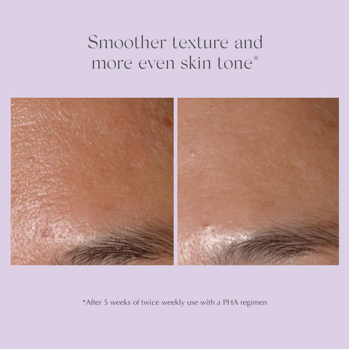 EXUVIANCE in-use on jawline illustrating targeted exfoliation benefits
