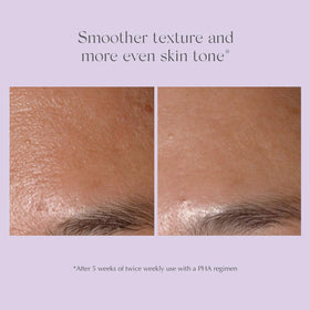 EXUVIANCE in-use on jawline illustrating targeted exfoliation benefits