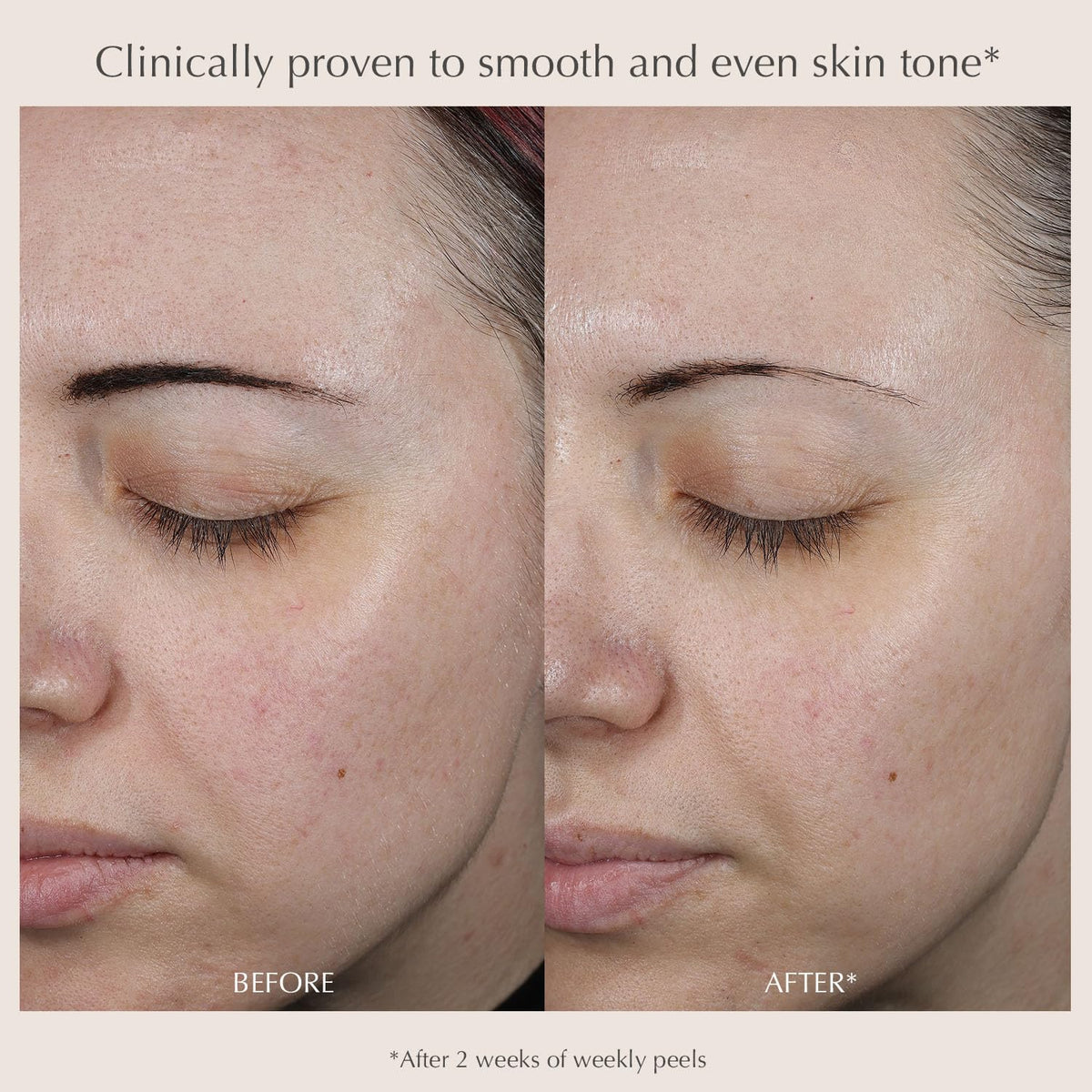 EXUVIANCE peel pad in hand demonstrating easy single-use application and controlled coverage