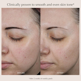 EXUVIANCE peel pad in hand demonstrating easy single-use application and controlled coverage