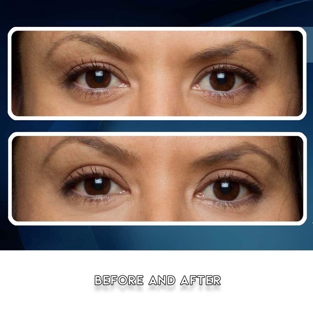Eye Magic pack beside ruler for size scale and refill quantity clarity