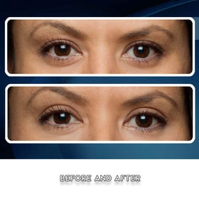 Eye Magic pack beside ruler for size scale and refill quantity clarity