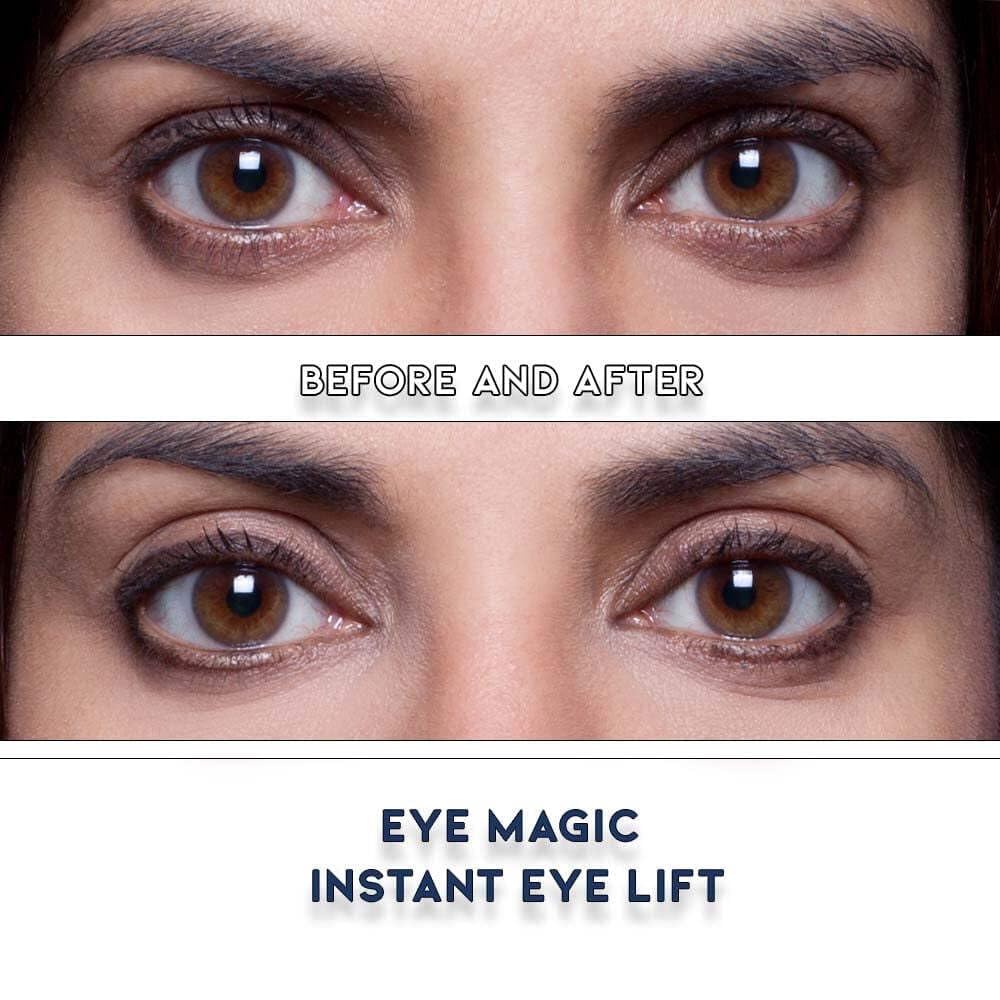Eye Magic strip applied on eyelid demonstrating immediate lift benefit