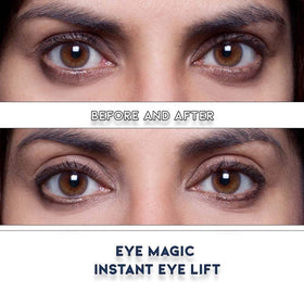 Eye Magic strip applied on eyelid demonstrating immediate lift benefit
