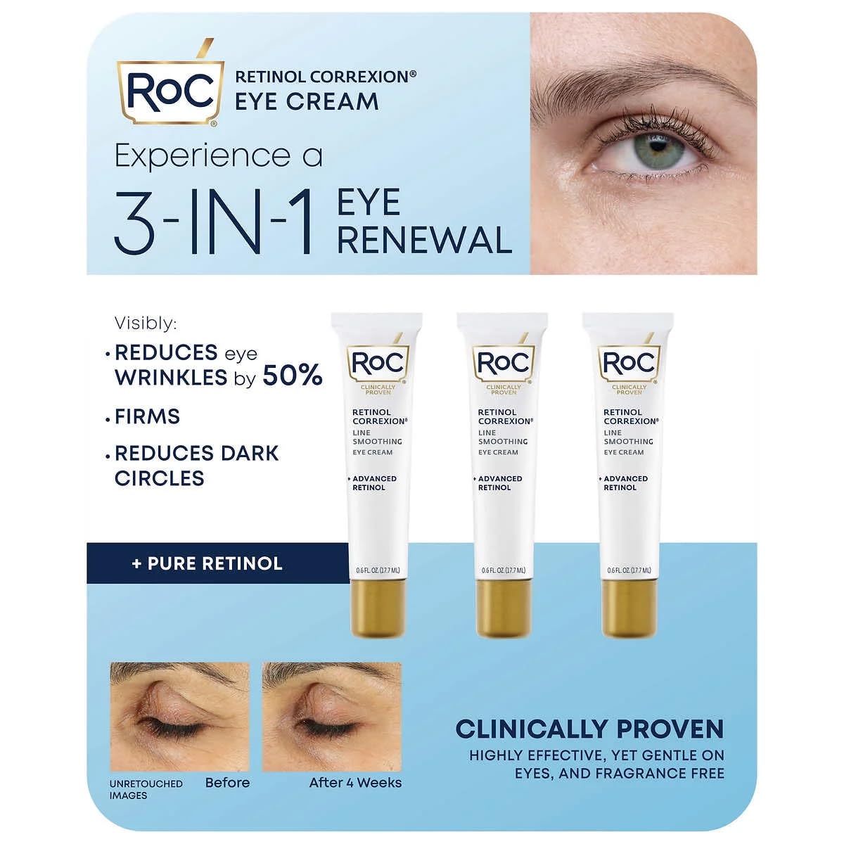 Eye See RoC front packaging showing trio pack and product benefit