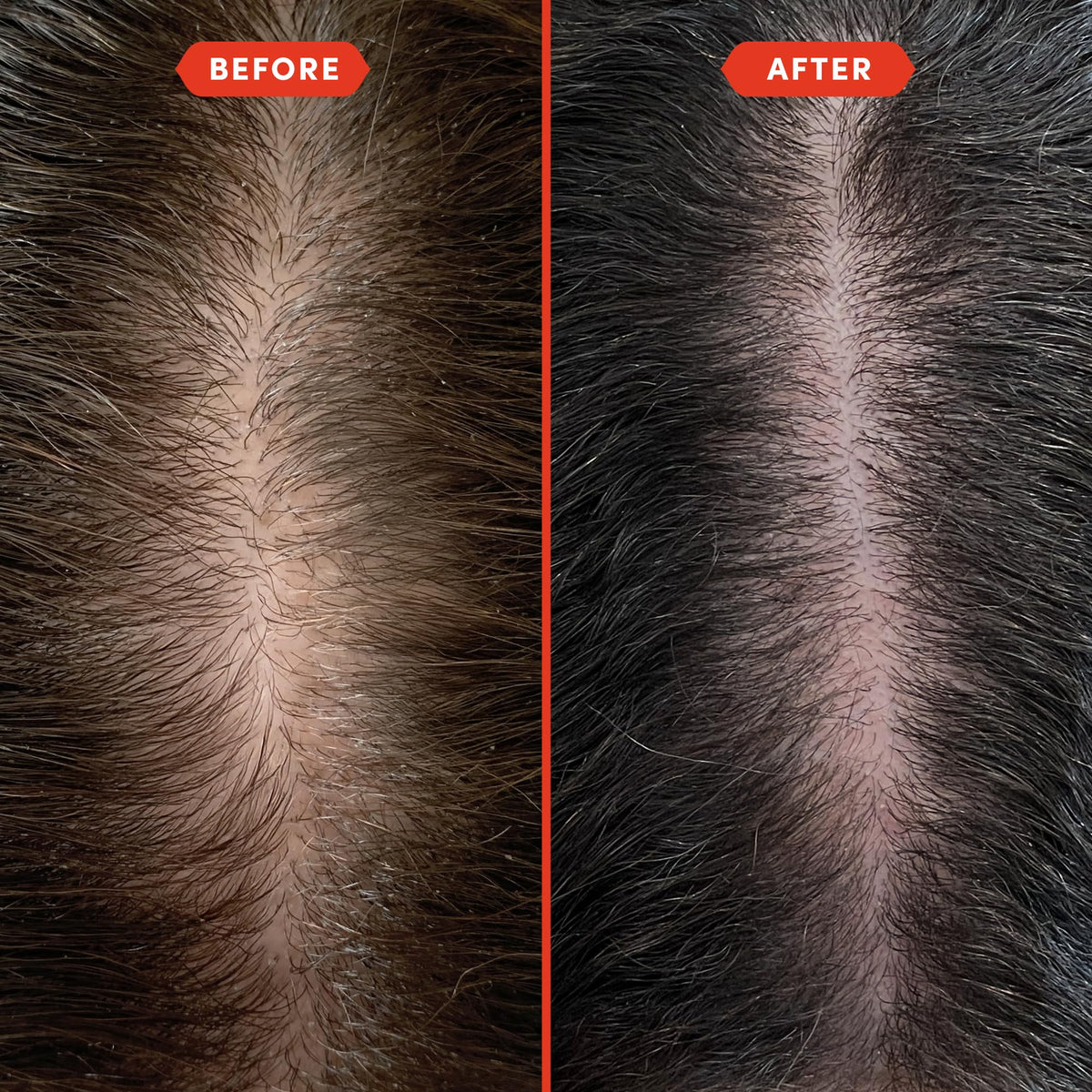 Fable & Mane applied to scalp during massage, illustrating improved circulation benefit