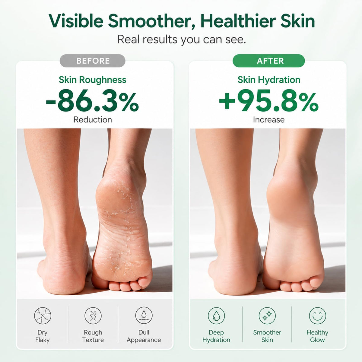 FAMIKYA being applied to heel demonstrating callus softening benefit