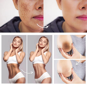 FAMIROSA cream being applied to underarm demonstrating hydration and comfort after use