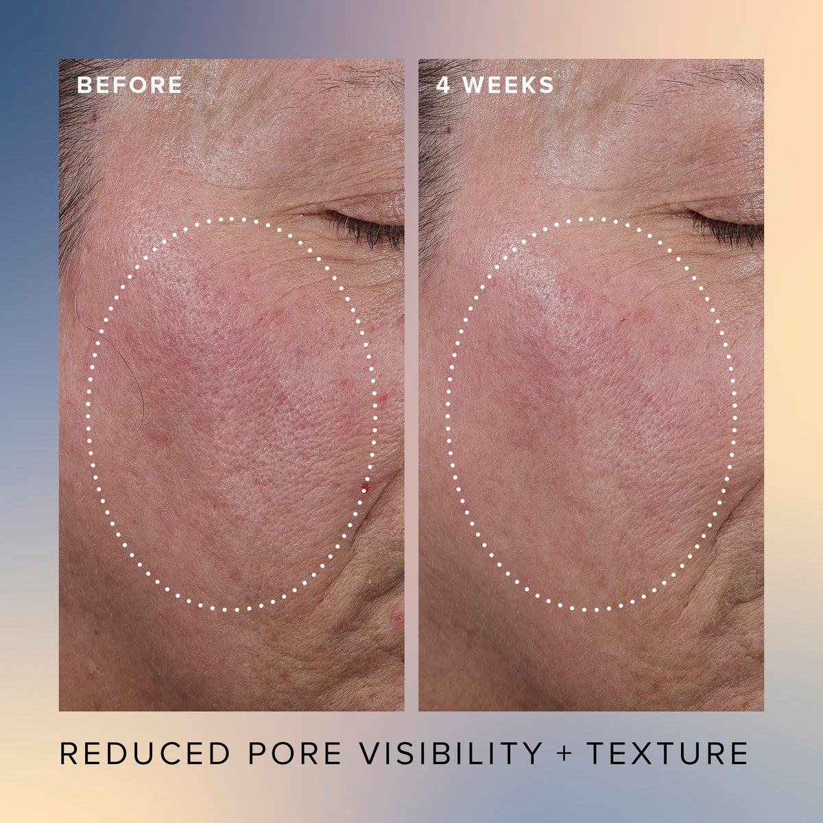 Close-up of silky serum texture, Farmacy showing lightweight hydrating finish benefit
