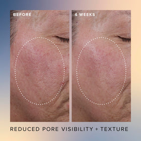 Close-up of silky serum texture, Farmacy showing lightweight hydrating finish benefit