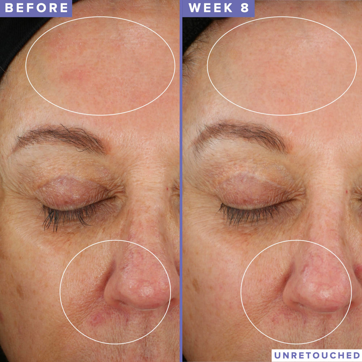 farmacy jar opened revealing product consistency and volume benefit