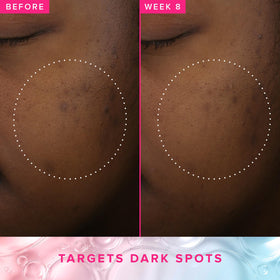Farmacy toner poured on hand demonstrating lightweight, hydrating feel