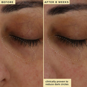 Farmacy eye cream on vanity showing morning skincare routine benefit