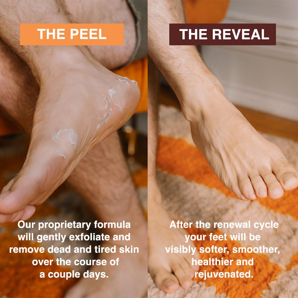 FEETS booties on feet during 60–90 minute treatment for convenience