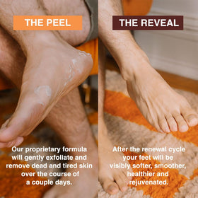 FEETS booties on feet during 60–90 minute treatment for convenience