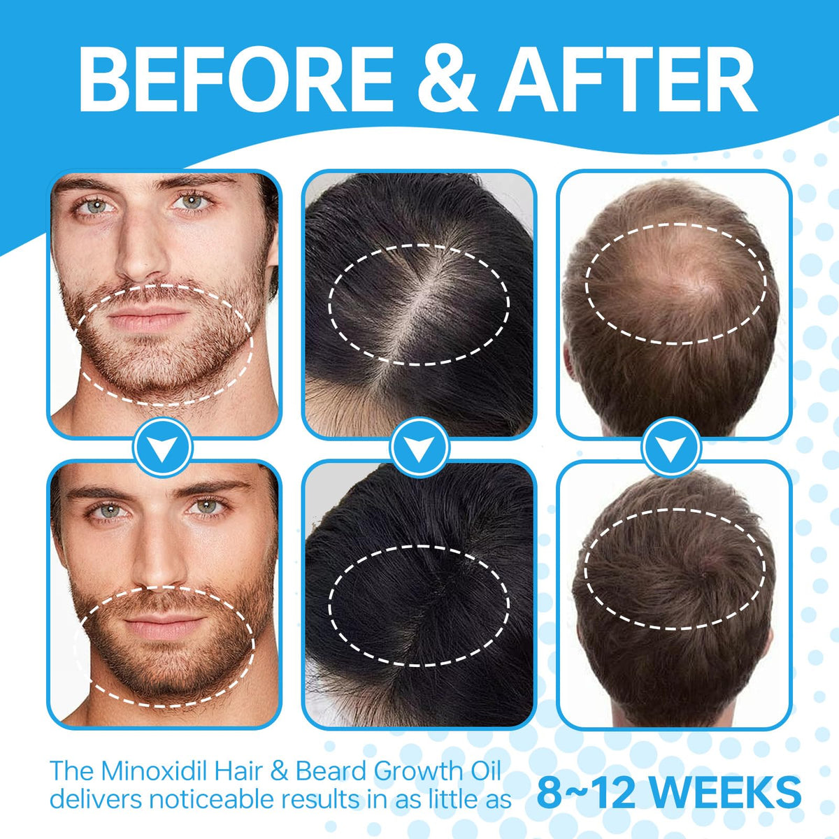 FIGTORUS applying serum to scalp illustrating easy targeted application