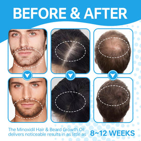 FIGTORUS applying serum to scalp illustrating easy targeted application