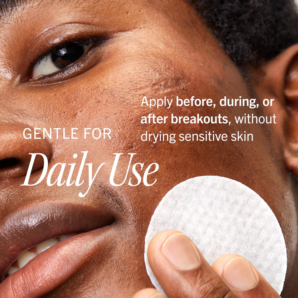 First Aid Beauty open jar revealing pre-soaked pads for hygienic single use