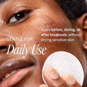 First Aid Beauty open jar revealing pre-soaked pads for hygienic single use