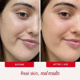 First Aid Beauty applying moisturizer to face for smooth, breathable finish benefit