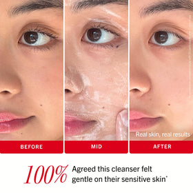 First Aid Beauty side-by-side before and after cleanse, shows clearer, calmer skin