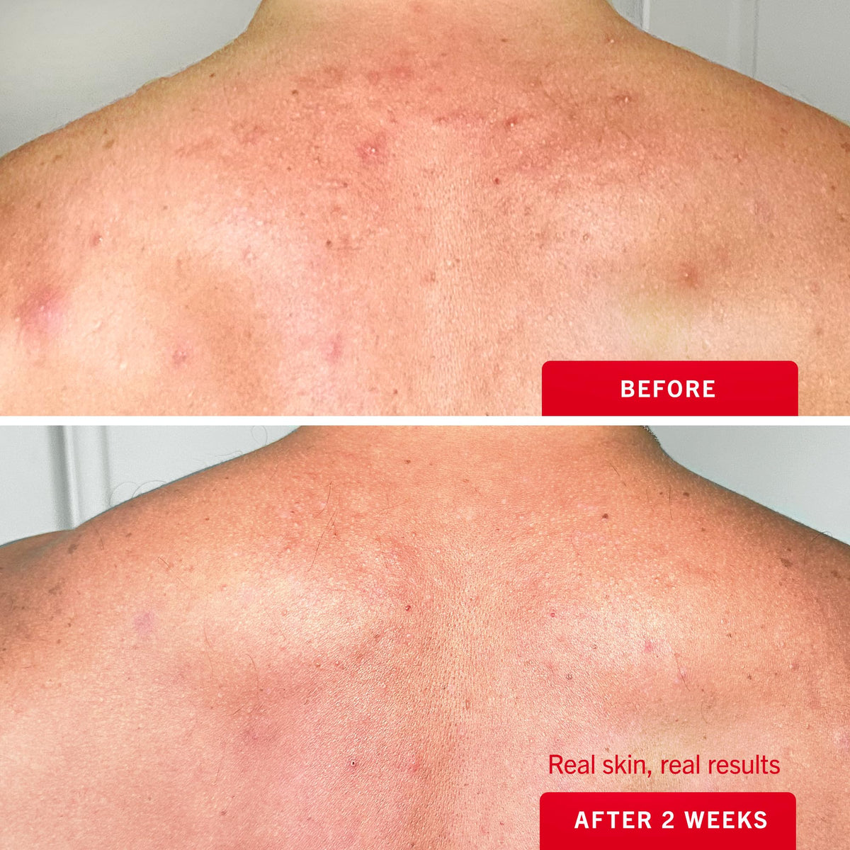 First Aid Beauty mist applied on shoulder showing quick-dry, non-sticky feel