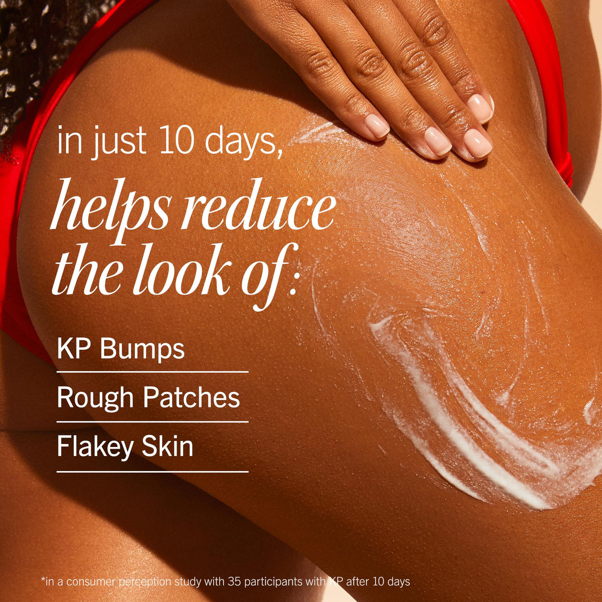 First Aid Beauty applied to upper arm showing smoothing of keratosis pilaris bumps