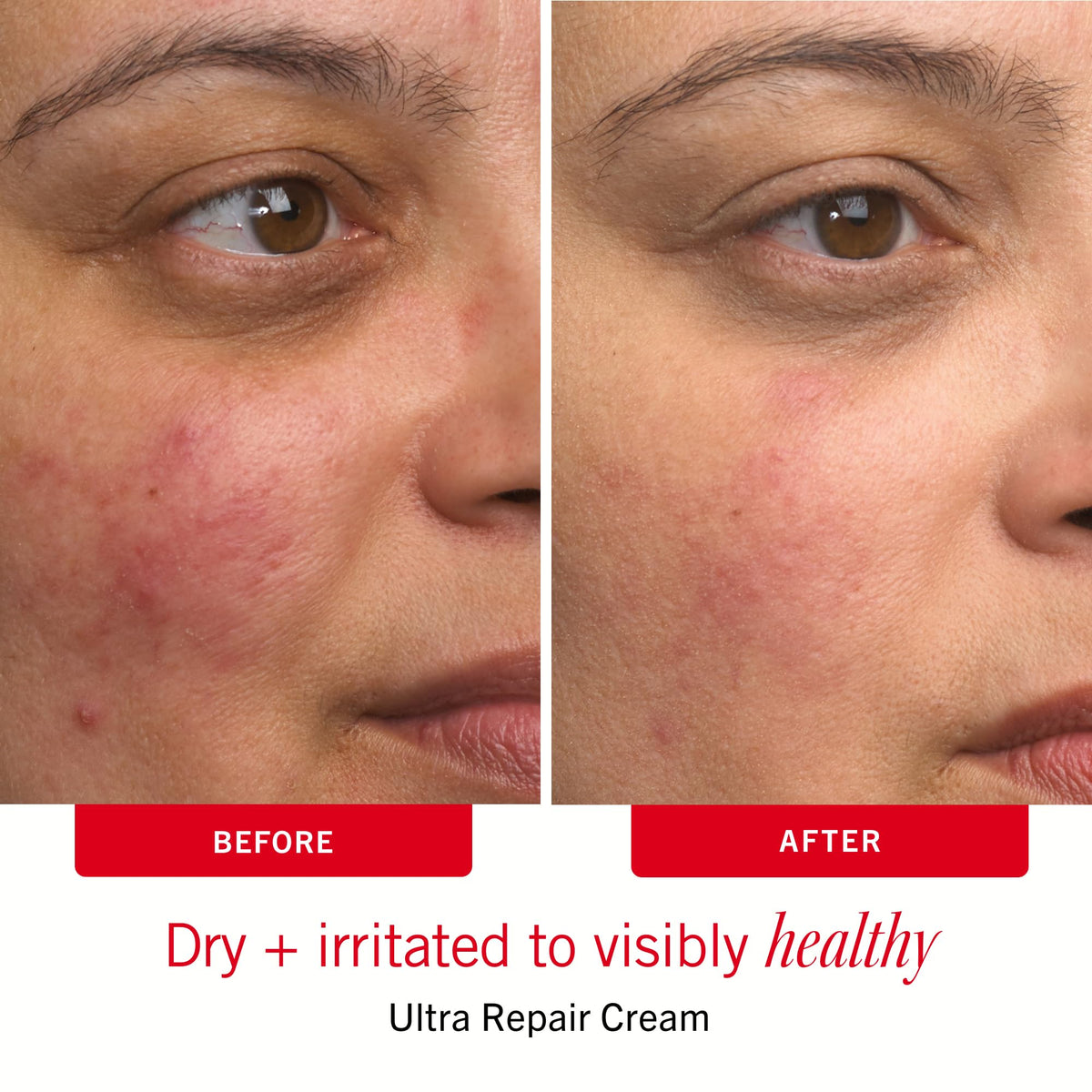 First Aid Beauty in a weekend bag lifestyle shot showing on-the-go sensitive skin care