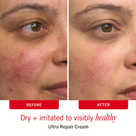 First Aid Beauty in a weekend bag lifestyle shot showing on-the-go sensitive skin care